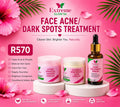 Face Acne/Dark Spots Treatment